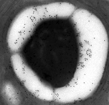 microscopie électronique montrant de l'amidon
