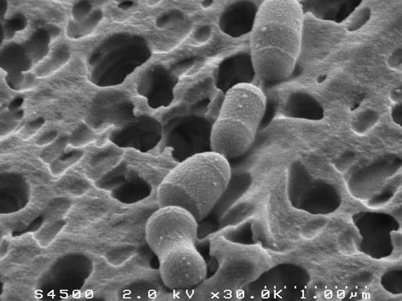 Bacteroides sp. Strain D8, the First Cholesterol-Reducing Bacterium Isolated from Human Feces - credit : INRA