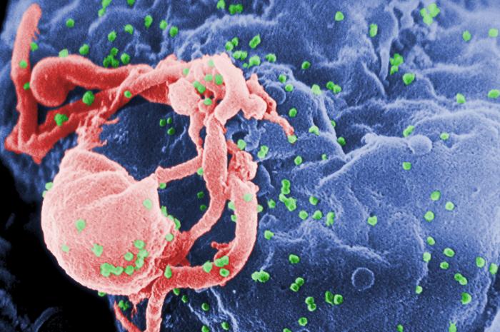 Sur cette image, le virus HIV (en rouge) est en train de bourgeonner sur les lymphocytes, des cellules protectrices de l'organisme. Ce virus est à l'origine du sida, une maladie qui détruit le système immunitaire humain. © Cynthia Goldsmith/CDC 