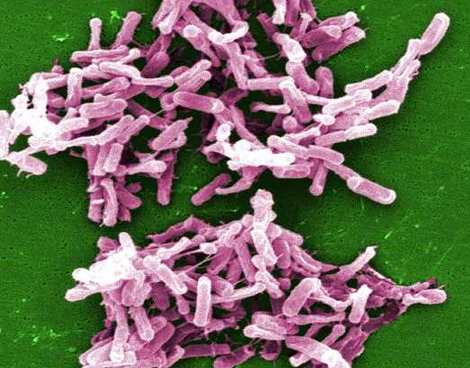 Clostridium difficile bacteria from a stool sample culture. C. diff is a very problematic pathogen in health care environments, as it produces endospores and is very difficult to destroy. Credit: CDC Janice Carr Public Health Image Library #999