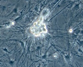 Neurones induits se développant sur les fibroblastes de souris dont ils sont issus. (Thomas Vierbuchen/Marius Wernig)