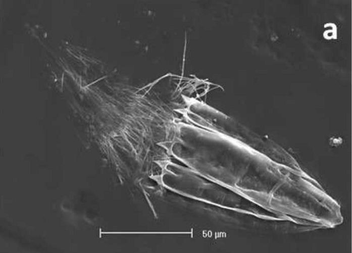 One of the multicelllar organisms found to be living without oxygen in the Mediterranean Sea - Image credits: Roberto Danovaro et al. / BMC Biology