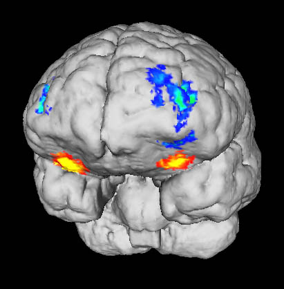 cerveau