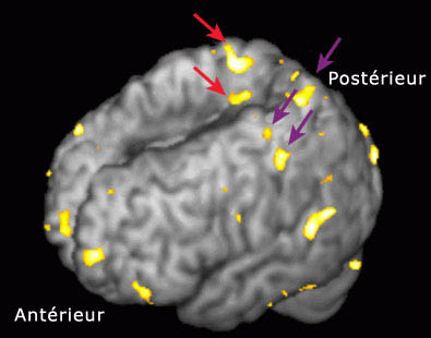  imagerie par résonance magnétique fonctionnelle