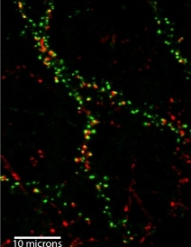 Les oligomères de béta amyloïde (rouge) se sont accumulés à proximité des synapses (vert). © Inserm