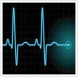 electrocardiogramme