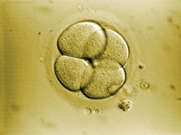 Cellules souches embryonnaires
