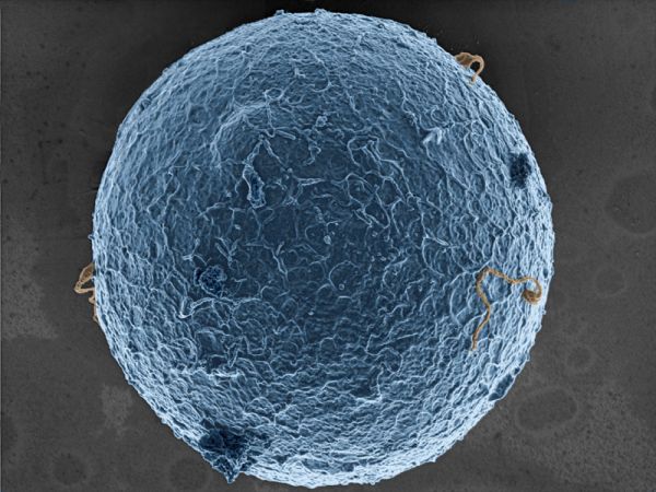 spermatozoides ovule