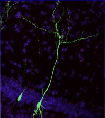 protéine fluorescente YFP