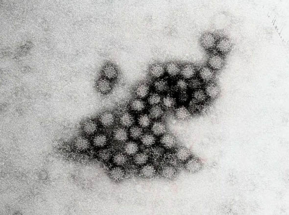 norovirus - gastroentérite