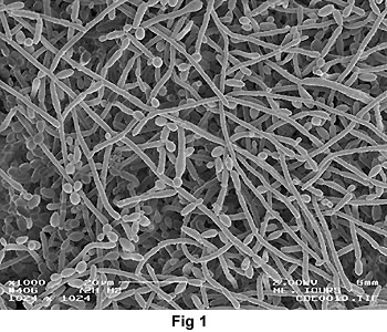 Biofilm de Candida albicans formé sur un support plastique (Microscopie électronique à balayage ; collaboration E. Arbeille, Université de Tours) 