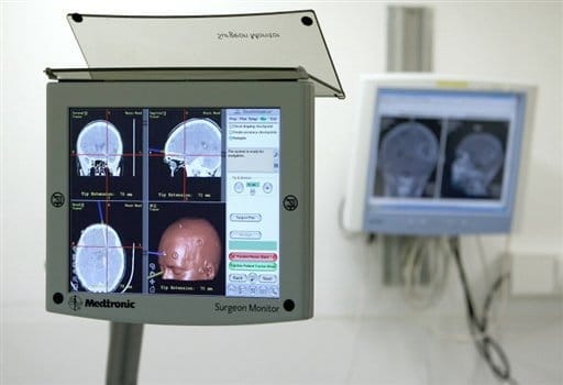 Photo d'un IRM (Imagerie par Résonnance Magnétique) dans un hôpital de Liège (Belgique), le 30 novembre 2007 - crédit : TV5