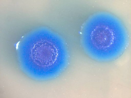 Photo non-datée de bactérie Mycoplasmes