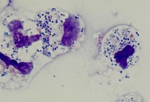 Streptocoques du groupe B dans du liquide céphalorachidien