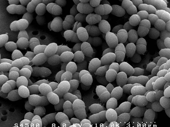 Streptococcus thermophilus