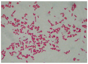 Yersinia pestis après coloration de Gram - © URMITE / CNRS